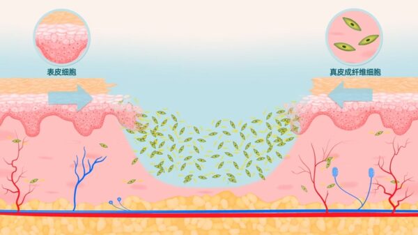 美容医疗动画_皮肤疤痕动画_斯赛医疗产品视频—【上海MG动画制作公司】 - 图片 4